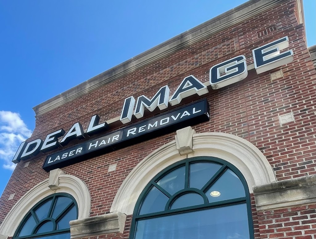 Ideal Image Greensboro | 1420 Westover Terrace F, Greensboro, NC 27408, USA | Phone: (336) 899-7811