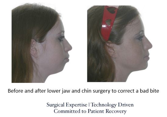 About Face Surgical Arts: Khurram A. Khan BDS, DMD | 7523 State Rd, Cincinnati, OH 45255, USA | Phone: (513) 232-8989