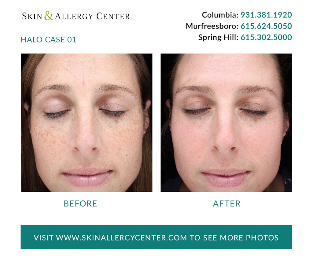 Skin & Allergy Center | 1229 Reserve Blvd Suite 200, Spring Hill, TN 37174, USA | Phone: (615) 302-5000