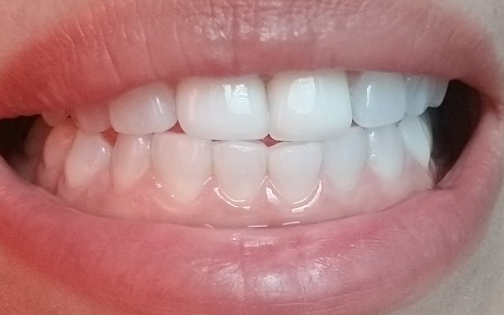 Luna Dental and Orthodontics | 2428 W Illinois Ave, Dallas, TX 75233, USA | Phone: (214) 330-0222
