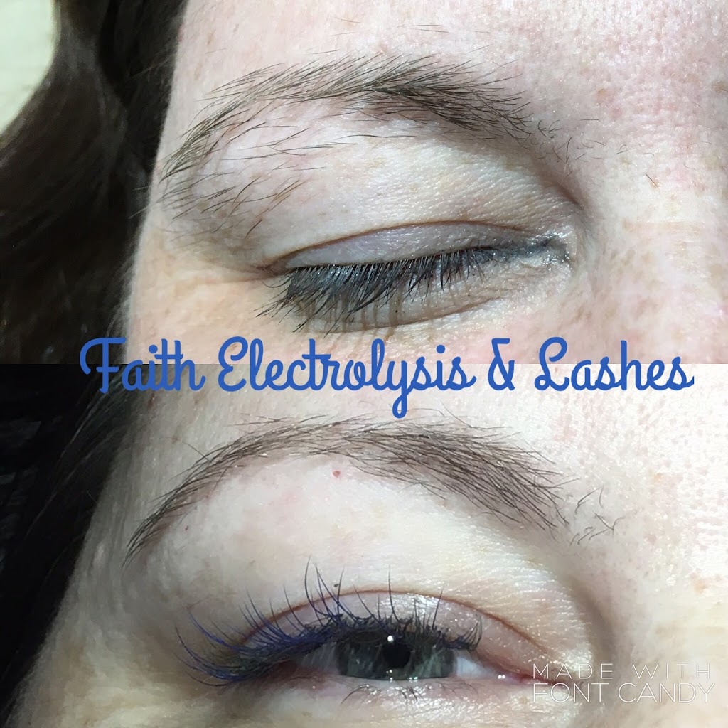 Faith Electrolysis | 212 Laurel Dr, Gardendale, AL 35071, USA | Phone: (205) 541-3419