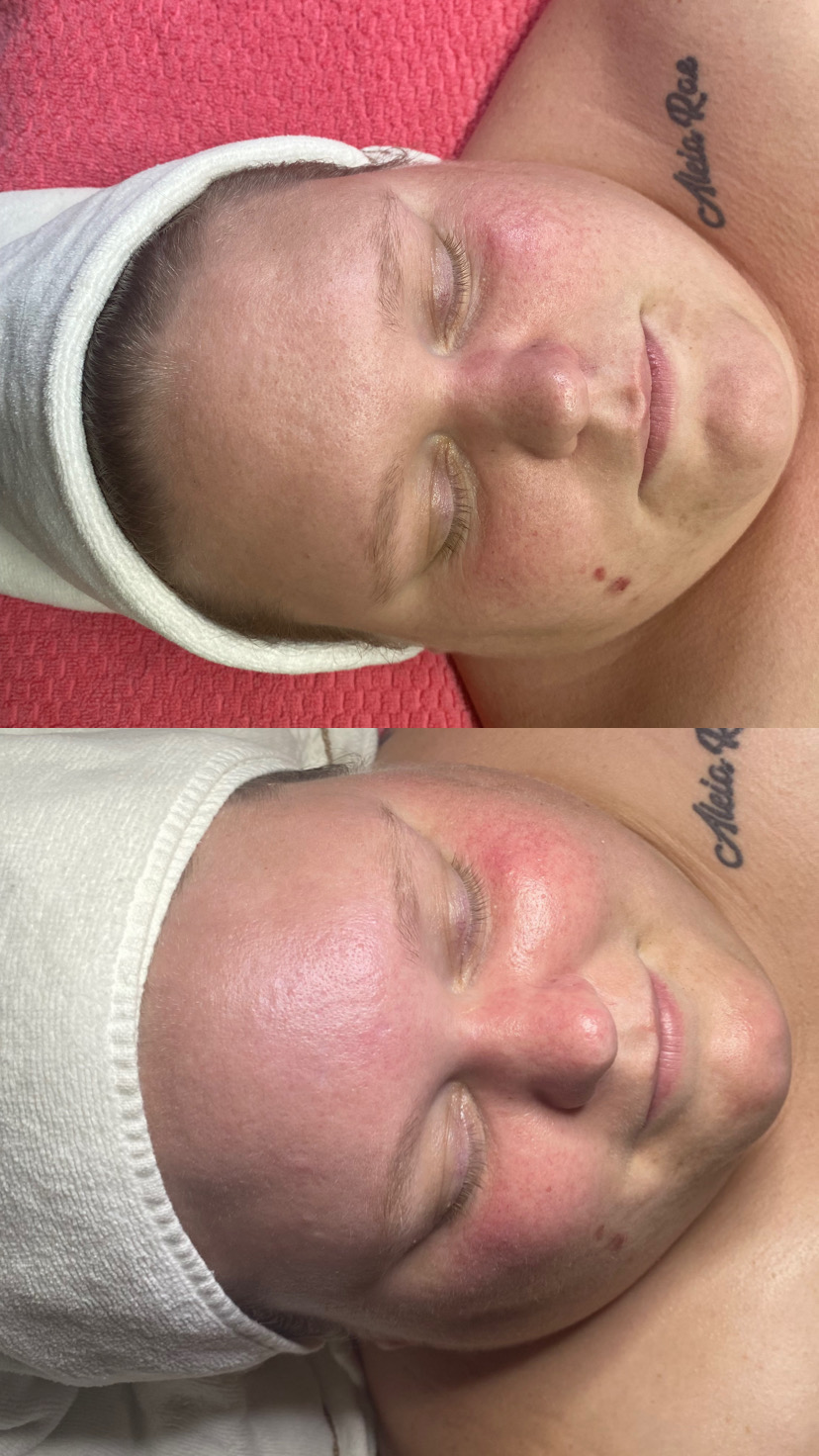 Luna Sol Aesthetics | 11407 US-301, Belleview, FL 34420, USA | Phone: (727) 318-3922