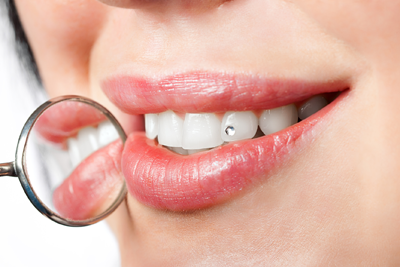 Macabi Dental Associates | 1025 Northern Blvd Suite#105, Roslyn, NY 11576, USA | Phone: (516) 869-9787