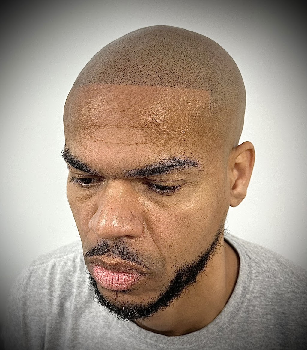 SCALP MICROPIGMENTATION | 2111 W Lincoln Hwy, Merrillville, IN 46410, USA | Phone: (630) 486-4502