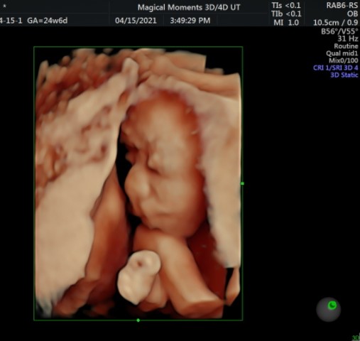 Magical Moments 3D/4D Ultrasounds | 20304 W Valley Blvd, Tehachapi, CA 93561, USA | Phone: (661) 972-4473