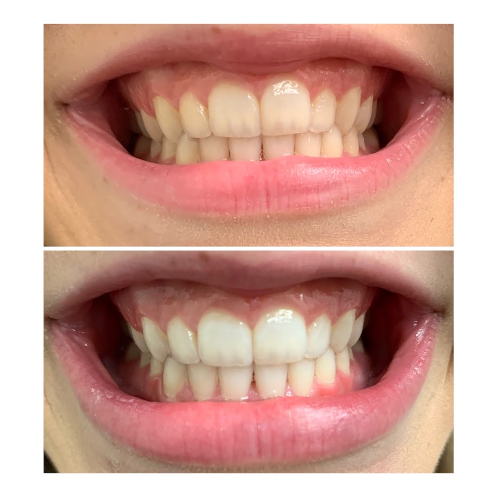 Smile Spa Teeth Whitening | 143 E Germann Rd building 101 suite 404, Gilbert, AZ 85297, USA | Phone: (480) 925-4050