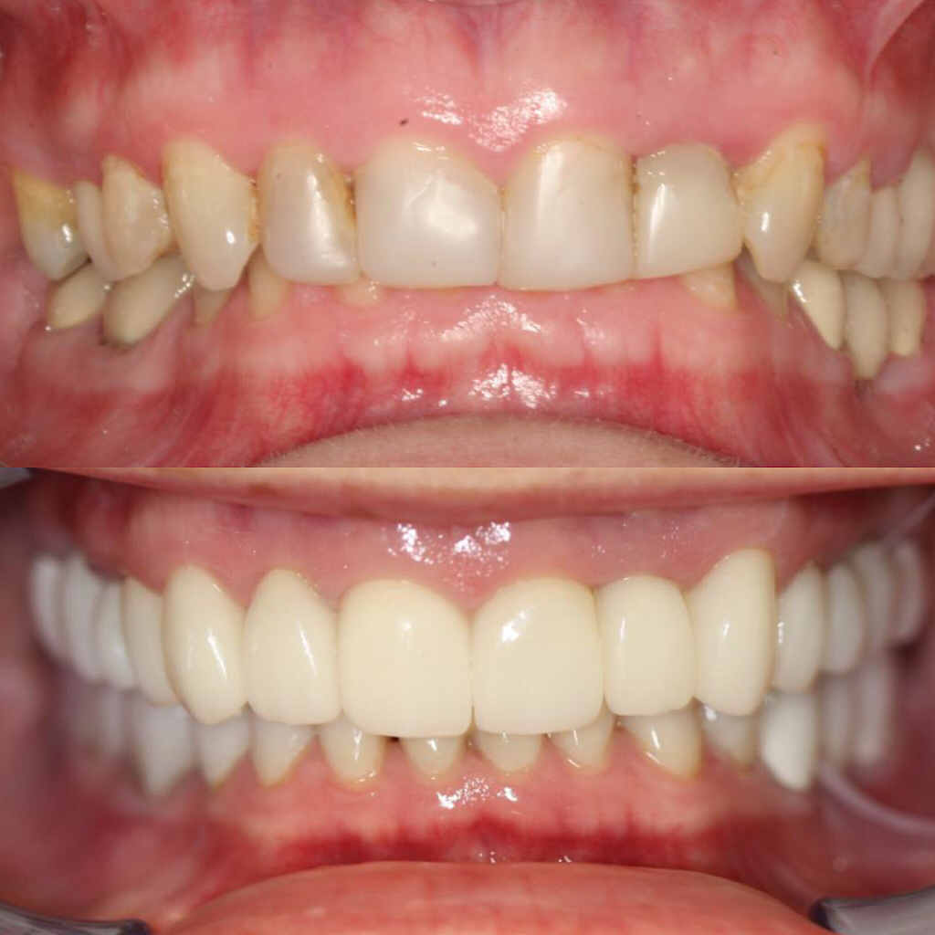 Tampa Dentist - Terrace Smiles Dentistry | 13214 Telecom Dr, Tampa, FL 33637, USA | Phone: (813) 977-7000