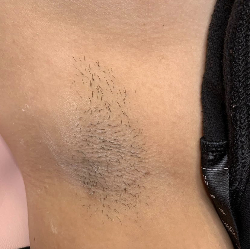 Dream Esthetics | 740 Texas St, Fairfield, CA 94534, USA | Phone: (707) 631-3583