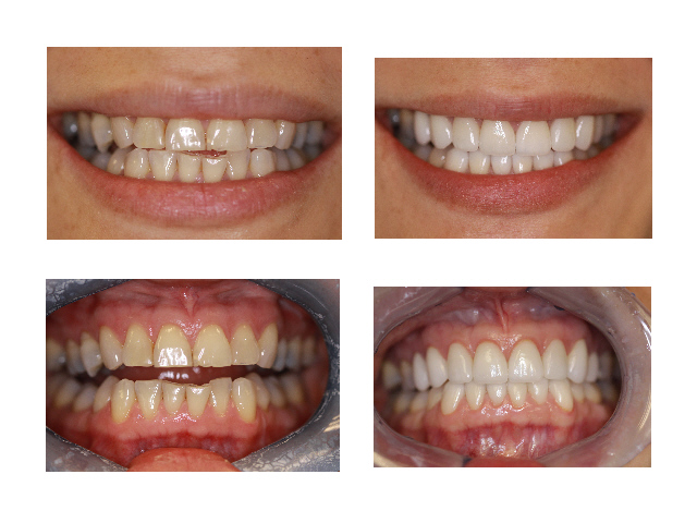 FC dental-Fairfax (Michael Song DDS, PC) | 3975 Fair Ridge Dr #301n, Fairfax, VA 22033, USA | Phone: (703) 385-5455