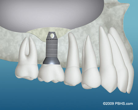 Longmont Oral, Facial & Implant Surgery | 1551 Professional Lane #260, Longmont, CO 80501, USA | Phone: (303) 772-8870