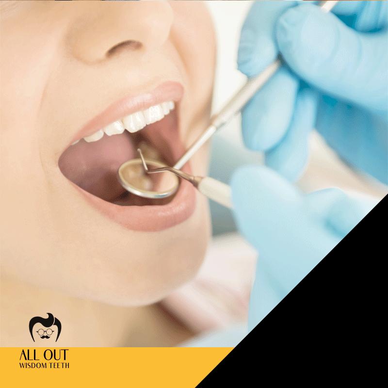 All Out Wisdom Teeth Las Vegas | 7670 W Lake Mead Blvd # 130, Las Vegas, NV 89128, United States | Phone: (702) 710-9006