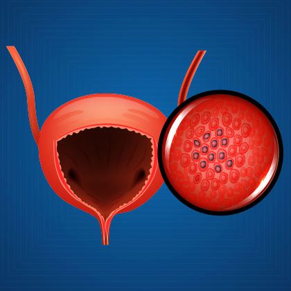 Urologist Tijuana | New City Medical Plaza, P.º del Centenario 9580 C 604, Zona Urbana Rio Tijuana, 22010 Tijuana, B.C., Mexico | Phone: (619) 392-8516