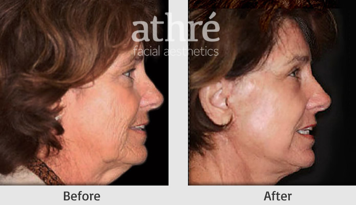 Athré Facial Plastics | 2121 Sage Rd #245, Houston, TX 77056, United States | Phone: (281) 557-3223