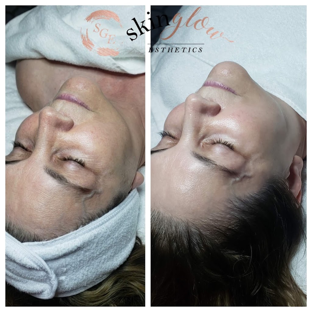 Skin Glow Esthetics | 380 Lowell St Suite 202B, Wakefield, MA 01880, USA | Phone: (978) 882-2833