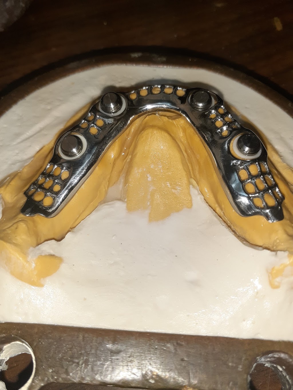 R&B Dental Lab | 21374 Ramona Ave, Apple Valley, CA 92307, USA | Phone: (760) 261-2425