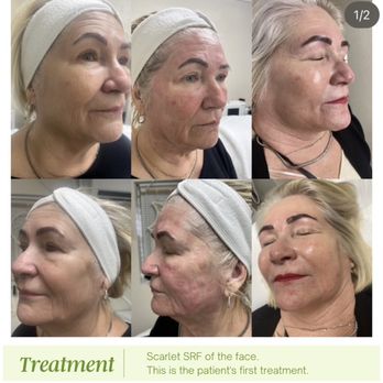 Rejuvenate & Wellness Center Lakeland | 4019 US Hwy 98 N Suite 124, Lakeland, FL 33809, USA | Phone: (321) 294-3586