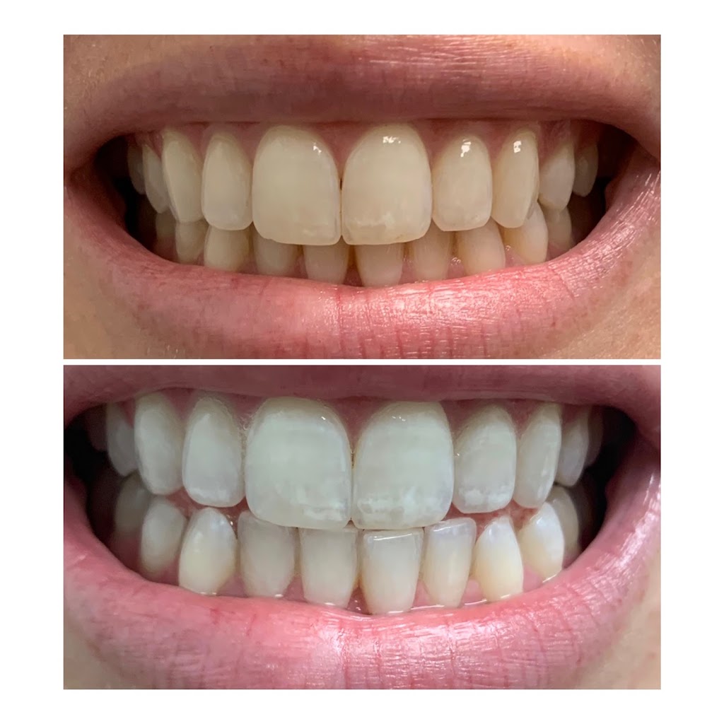 Smile Spa Teeth Whitening | 143 E Germann Rd building 101 suite 404, Gilbert, AZ 85297, USA | Phone: (480) 925-4050