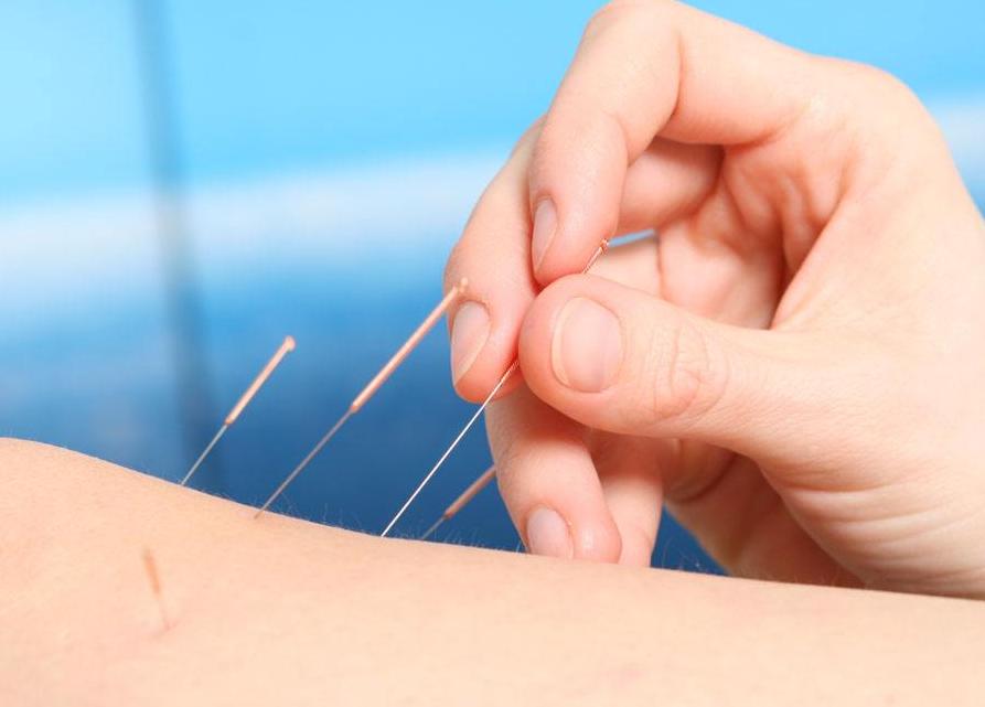 ZERO DISTANCE ACUPUNCTURE | 1736 Cope Ave E Suite A2, Maplewood, MN 55109, USA | Phone: (612) 261-7300