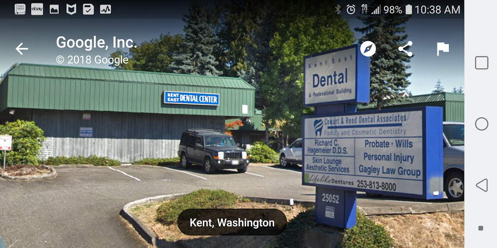 SHINE Family Dentistry (Former Black Diamond Dentistry of Kent) | 25052 104th Ave SE E, Kent, WA 98030 | Phone: (253) 852-8787