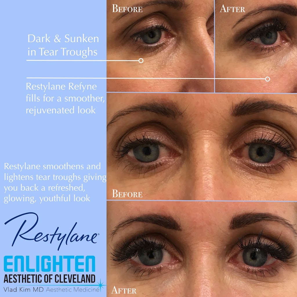 Enlighten Aesthetic of Cleveland: Laser Tattoo Removal, Fillers, Botox & PRP | 5187 Mayfield Rd Suite 102, Lyndhurst, OH 44124, USA | Phone: (440) 449-7707