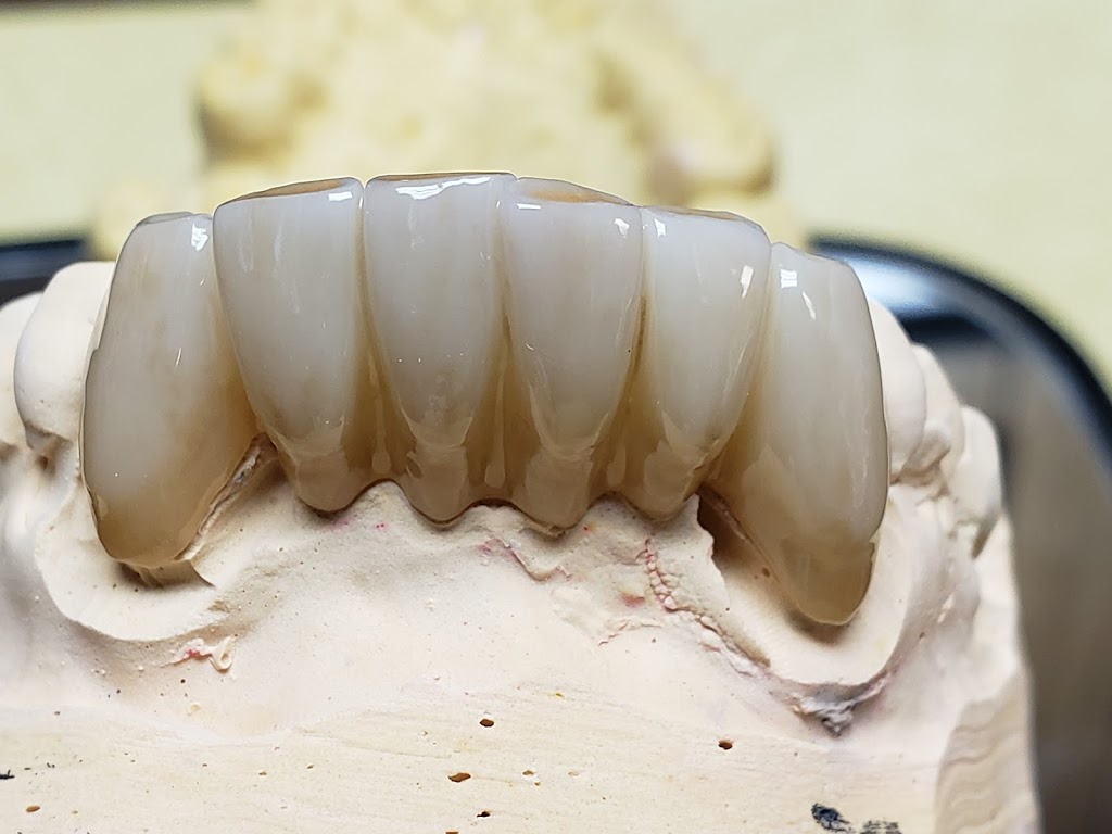 3D Dental Lab Inc | 2427 Baker Dr suite a, Mesquite, TX 75150, USA | Phone: (972) 270-9995