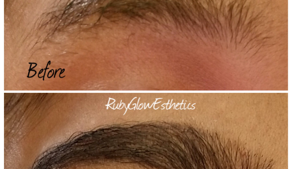 Ruby Glow Esthetics | 1621 Banning Beach Rd, Tavares, FL 32778, USA | Phone: (352) 235-9604