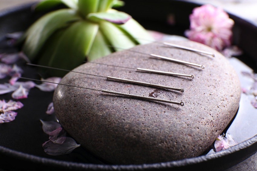 Eastern Wellness Acupuncture | 83 Montgomery Ave, Scarsdale, NY 10583, USA | Phone: (914) 472-6688