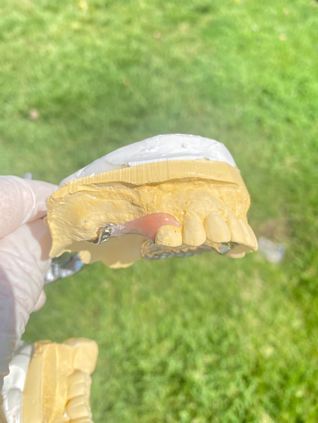 Martigon Dental Lab | 12684 Atherton Dr, Moreno Valley, CA 92555, USA | Phone: (951) 247-3459