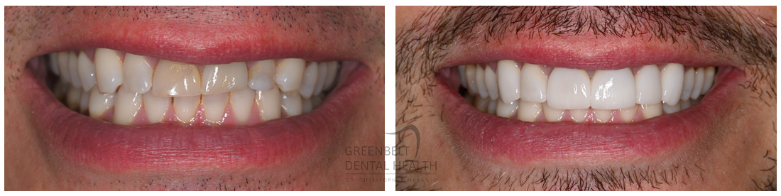 Greenbelt Dental Health | 1301 W 25th St #402, Austin, TX 78705, United States | Phone: (512) 472-3565