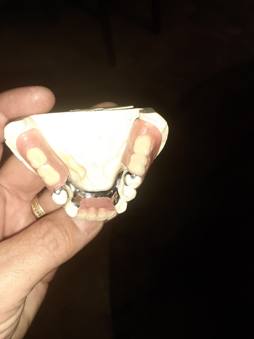 R&B Dental Lab | 21374 Ramona Ave, Apple Valley, CA 92307, USA | Phone: (760) 261-2425