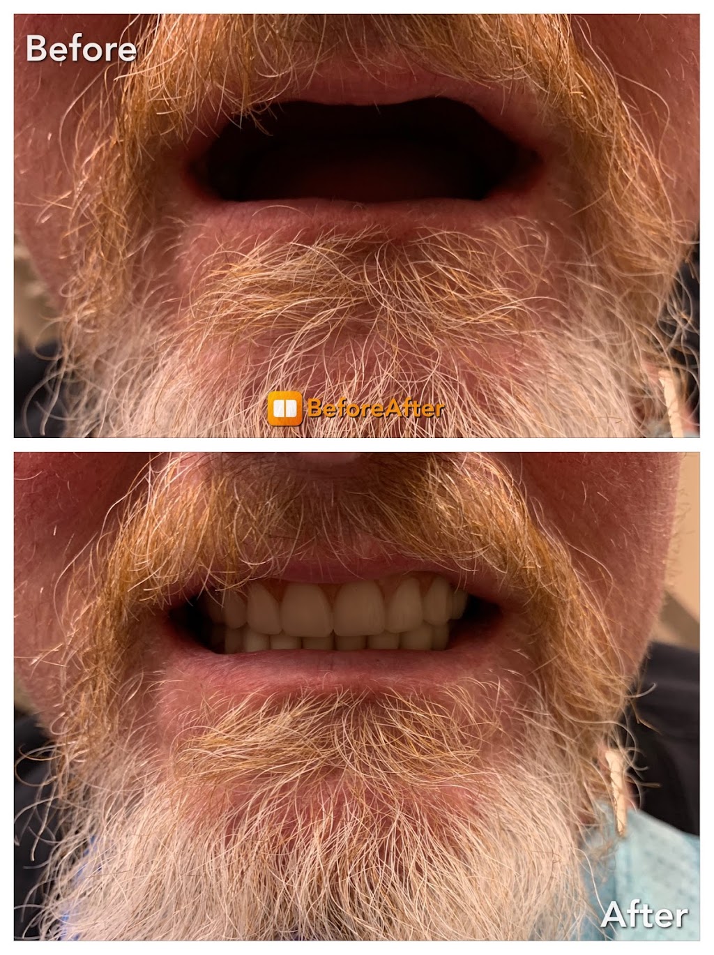 Direct Dental Lab (Denture Repair Service) | 9111 W Viking Rd, Las Vegas, NV 89147, USA | Phone: (818) 726-7468