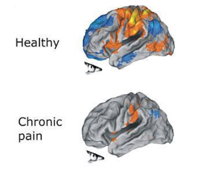 The Brain Reset QNRT | 4558 Winfield Dr, Nashville, TN 37211, USA | Phone: (615) 417-1447