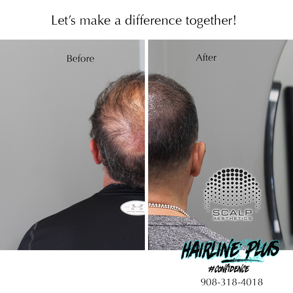 Hairline Plus | 1050 Stuyvesant Ave, Union, NJ 07083, USA | Phone: (908) 318-4018