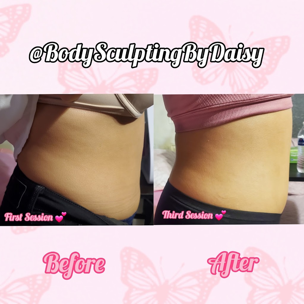 Body Sculpting By Daisy | 8652 Laurel Canyon Blvd, Sun Valley, CA 91352, USA | Phone: (818) 749-5549