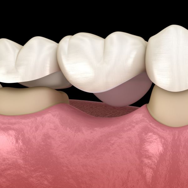 Meydenbauer Dental | 13033 Bel-Red Rd #220, Bellevue, WA 98005, United States | Phone: (425) 276-0737