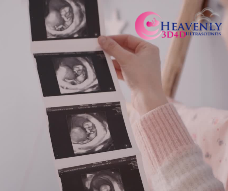 Heavenly 3D 4D Ultrasounds | 1365 W Foothill Blvd #5, Upland, CA 91786, USA | Phone: (888) 523-3343