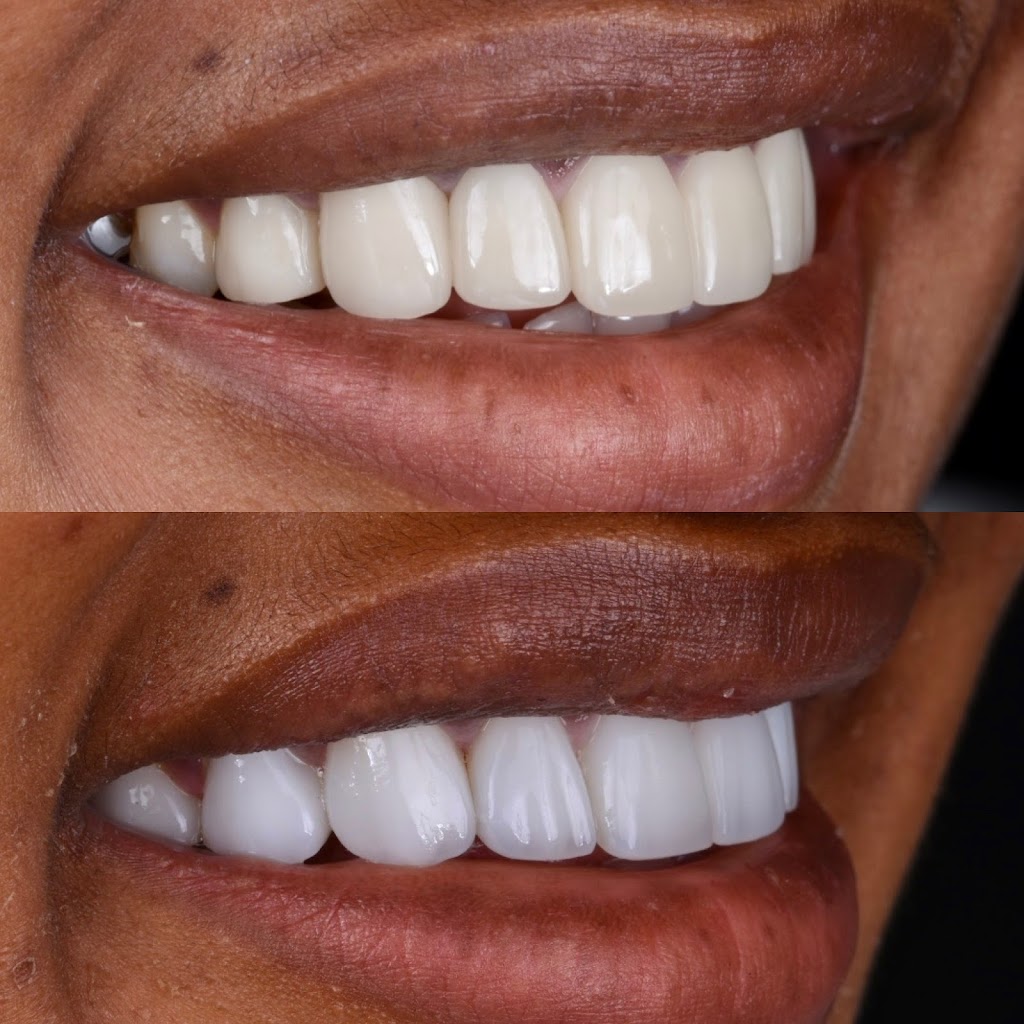 Modern Smiles | 10545 Victory Blvd, North Hollywood, CA 91606, USA | Phone: (818) 763-9353