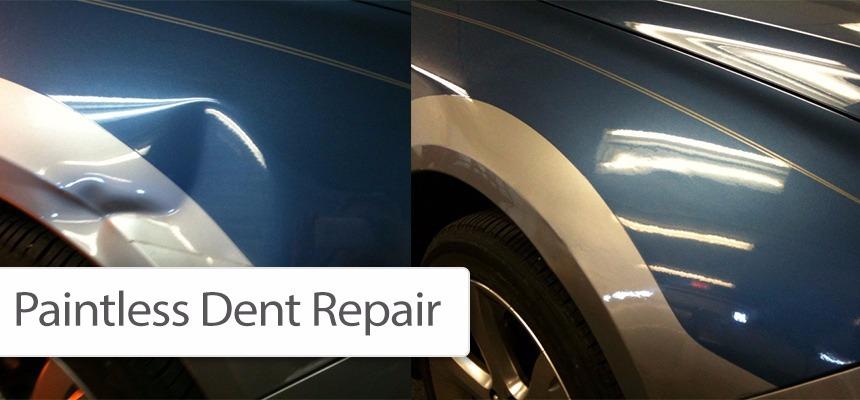 Nashville Dent Company | 1603 W Wilson Blvd, Mt. Juliet, TN 37122 | Phone: (615) 969-9036