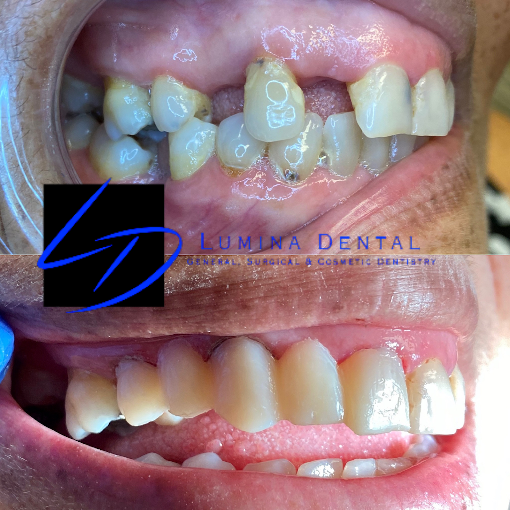 Lumina Dental | 2425 Brunello Trce, Lutz, FL 33558, USA | Phone: (813) 406-4848