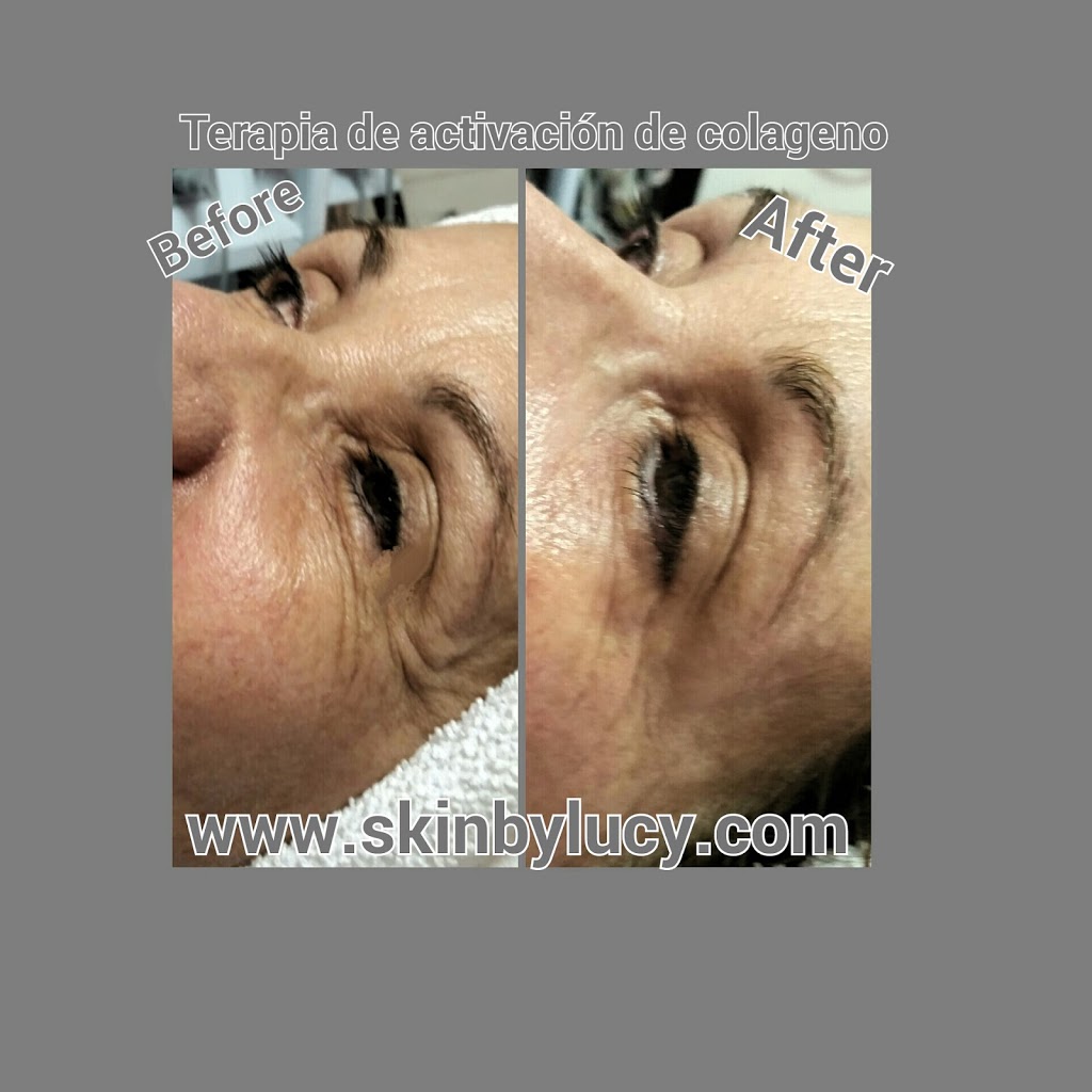 Skin By Lucy Med | 7000 Parkwood Blvd e100, Frisco, TX 75034, USA | Phone: (972) 854-2267