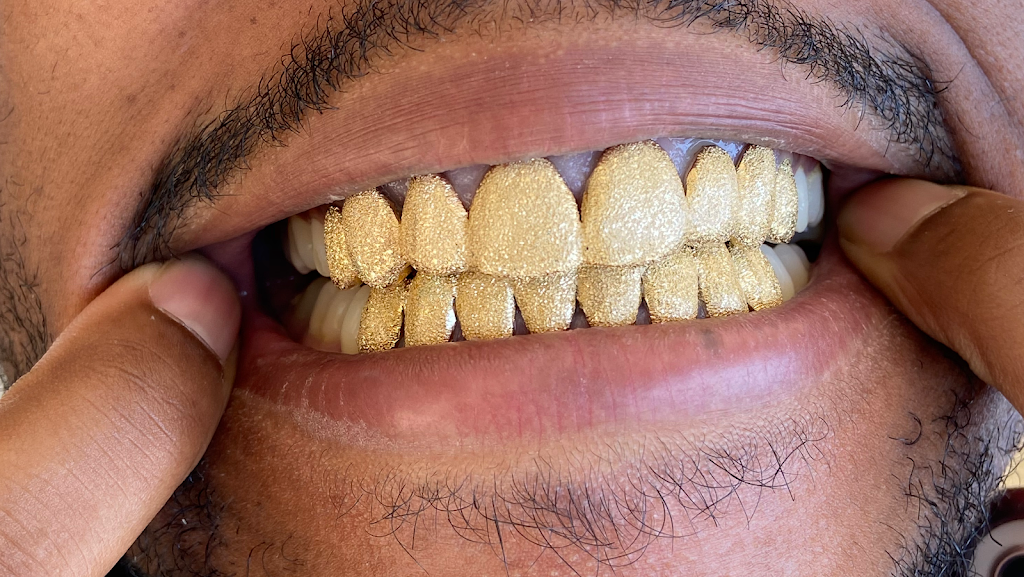 Mesa Gold Grillz LLC | 2105 S 48th St Suite 109, Tempe, AZ 85282, USA | Phone: (855) 290-4653