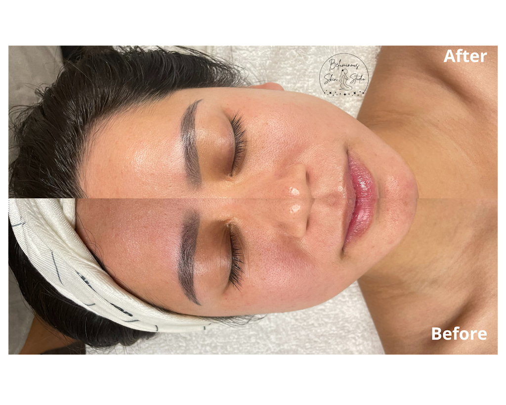 Beluminous Skin Studio | 763 S Main St Suite 121, Orange, CA 92868, USA | Phone: (714) 553-1466