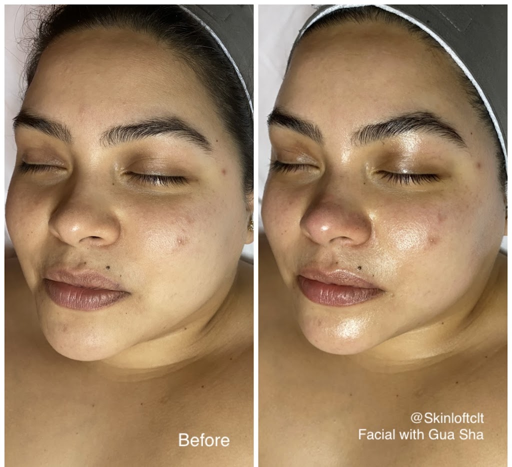 Skin Loft | 9904 Sandy Rock Pl, Charlotte, NC 28277, USA | Phone: (704) 582-2034