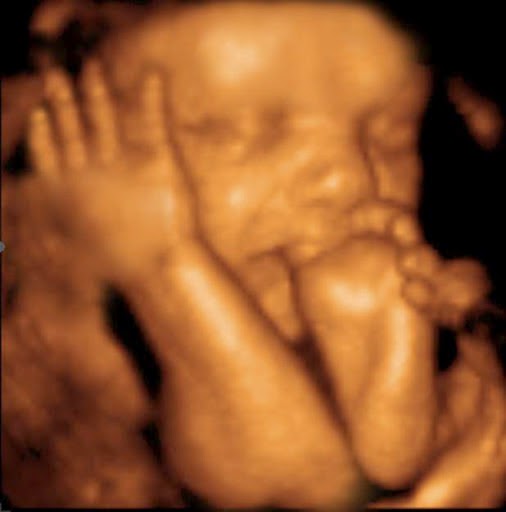 Peek a Belly 3D, Inc | 16626 W 159th St Ste 701, Lockport, IL 60441, USA | Phone: (815) 524-3963