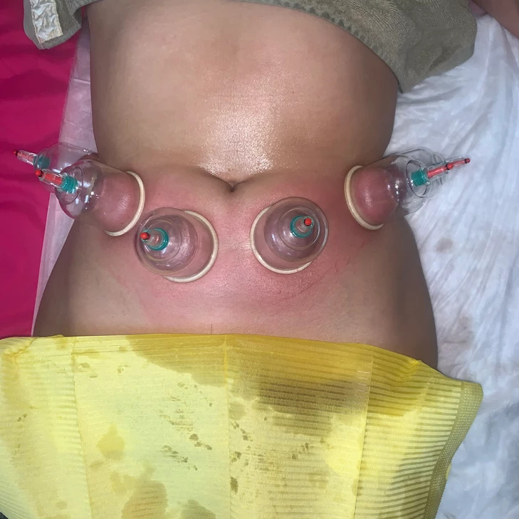 Beauty and Body | 1115 Via Verde, San Dimas, CA 91773, USA | Phone: (626) 838-6908