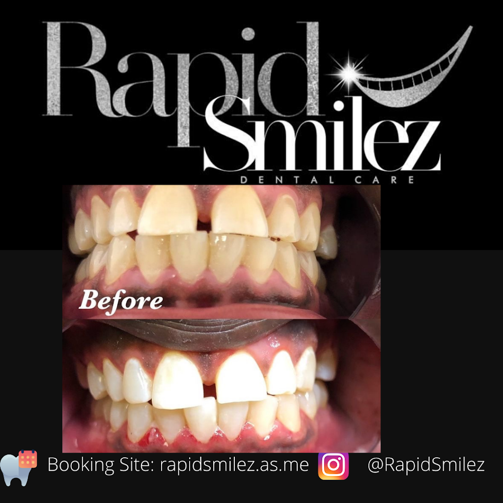 Rapid Smilez | 5611 W Fayetteville Rd #101, Atlanta, GA 30349, USA | Phone: (866) 438-8837