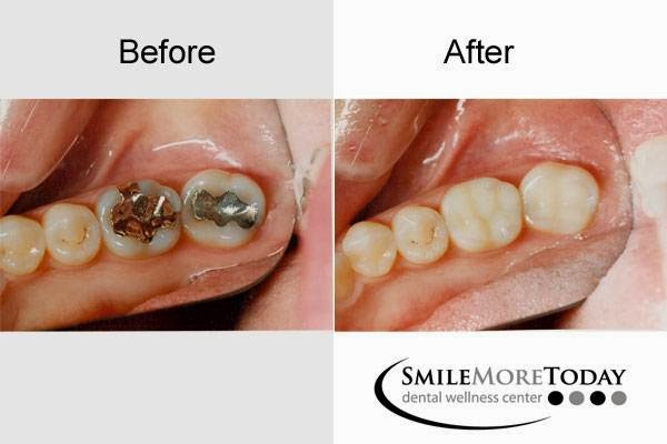 Smile More Today | 250 Center Dr #202, Vernon Hills, IL 60061 | Phone: (847) 247-1700