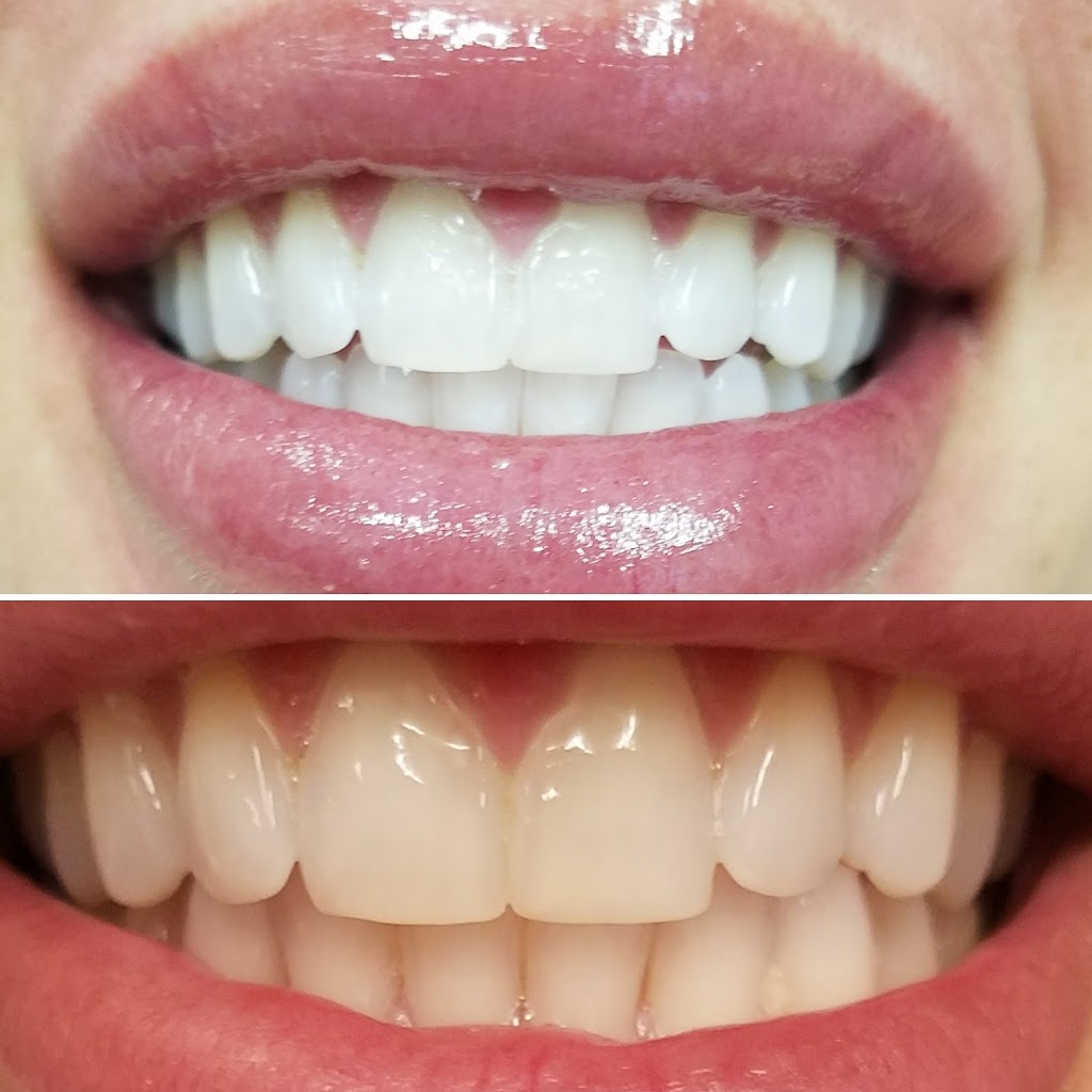 Whitenex Teeth Whitening | 2315 Imperial Hwy Suite 114, Brea, CA 92821, USA | Phone: (714) 266-6060