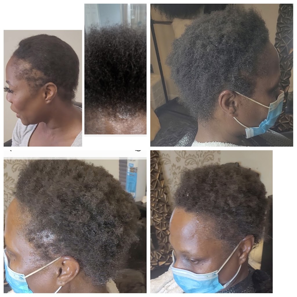 Weave Dr.s Wig & Hair Loss Clinic | 3231 Superior Ln a21, Bowie, MD 20715, USA | Phone: (703) 973-7146