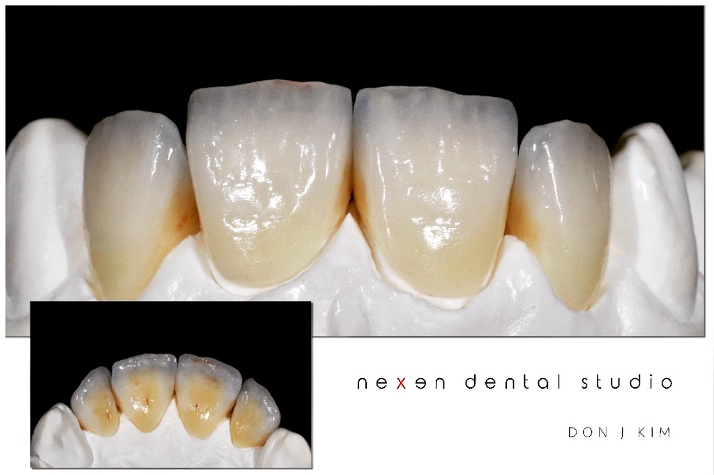 Nexen Dental Studio | 6552 Bolsa Ave. Ste #C, Huntington Beach, CA 92647, USA | Phone: (714) 622-5945